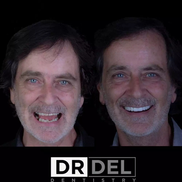 Slider image (7) DaVincis Dental Care Esthetic and Implant Dentistry